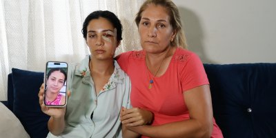 Eski eşinden şiddet gören kadın: "Ben yaşarken kurtulayım, öldükten sonra değil"