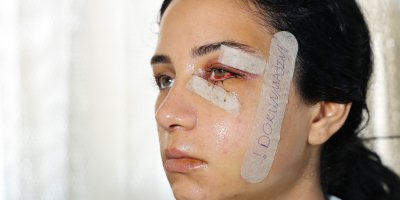 Eski eşini dövüp serbest kalan şüpheli tutuklandı