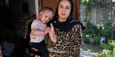 Balık pulu ve kelebek hastası Yusuf'un yardım paralarını dolandırıcılar topladı