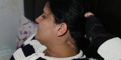 Eşi boğazını kesti engelli kaldı: 2 çocuk annesi dehşet anlarını ilk kez anlattı