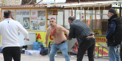 Adana'da gergin yıkım: Dükkanlar yakıldı, bir kişi kendine zarar verdi