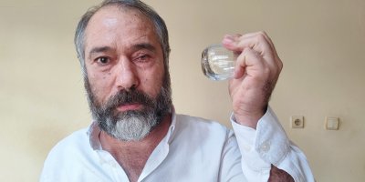 ‘Küfürlü konuşmayın' diye uyardı, gözünden oldu