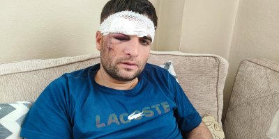 Döner ustası motosiklet sürücüsü: "Kaza sonrası kaçıp gittiler"