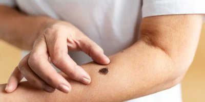 Nacar: Cildinizi Koruyun, Hayatınıza Değer Katın