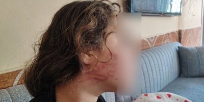 8 yaşındaki kızını darp eden çocuğun epilepsi hastası ablasını darp ettiler