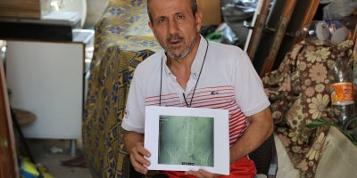 İş kazası sonrası ameliyat oldu, hayatı kabusa döndü