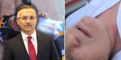 Vali Çeber’den Melih Meriç saldırısına ilişkin açıklama: “Saldırganın 27 suç kaydı var”