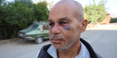 Kozan’da duyma ve konuşma engelli adam darbedildi: 1 kişi gözaltında