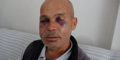 Kozan’da engelli adamı darbeden şüpheli serbest bırakıldı
