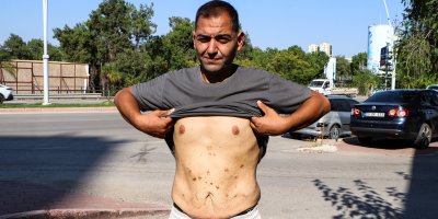 Adana'da tüp mide ameliyatı sonrası sağlık sorunları yaşayan İlkcan: "Günden güne eriyorum, yardımcı olun"