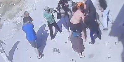 Çocukların gürültüsü nedeniyle çıkan kavgada aynı aileden 3 kişi yaralandı