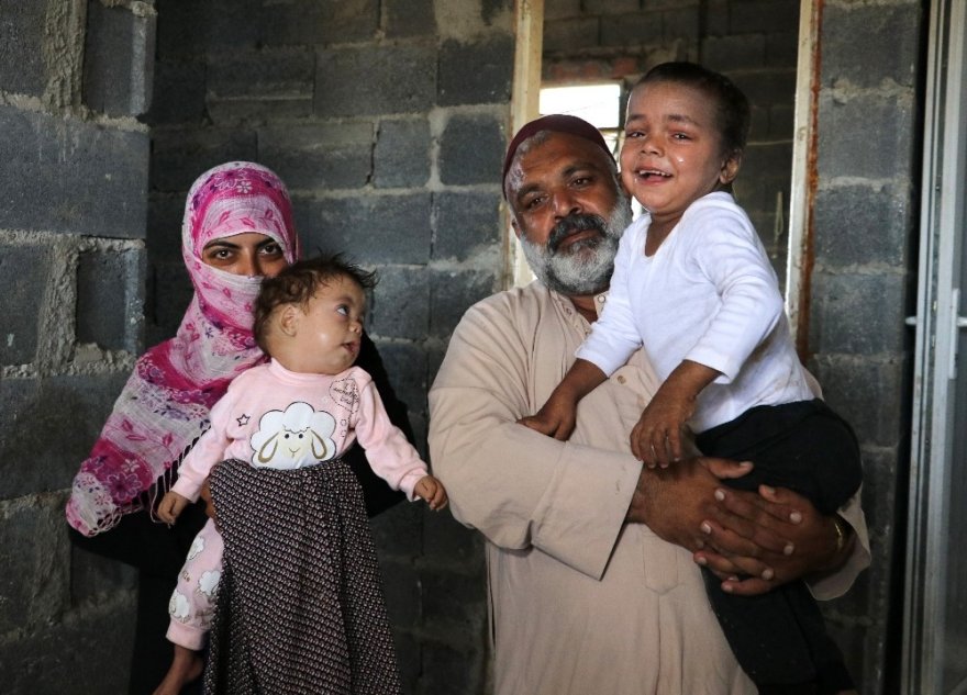 Balık pulu hastası kardeşler yardım bekliyor