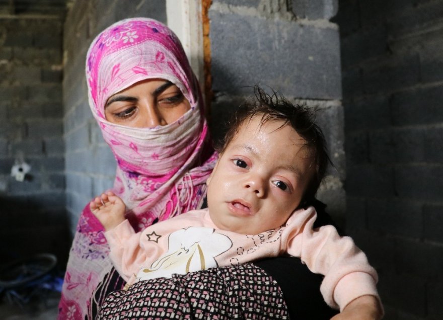 Balık pulu hastası kardeşler yardım bekliyor