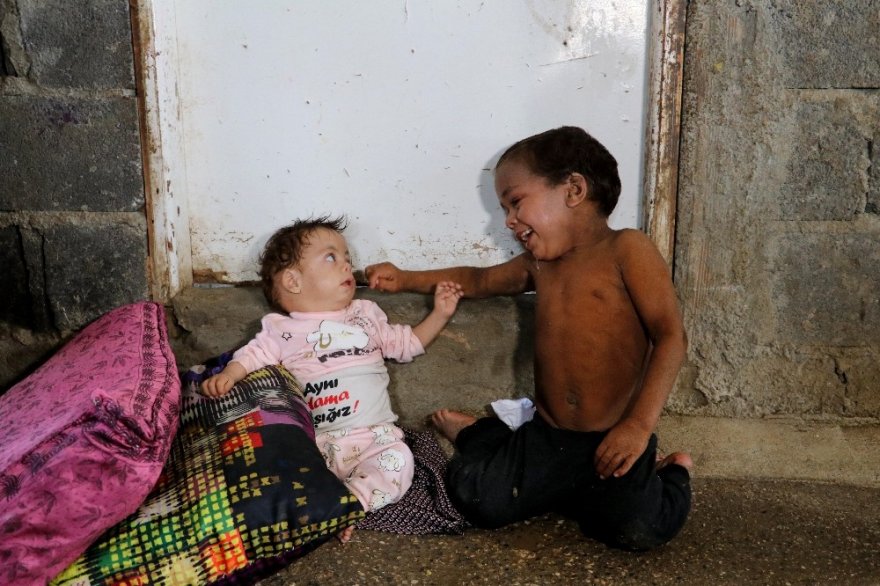 Balık pulu hastası kardeşler yardım bekliyor