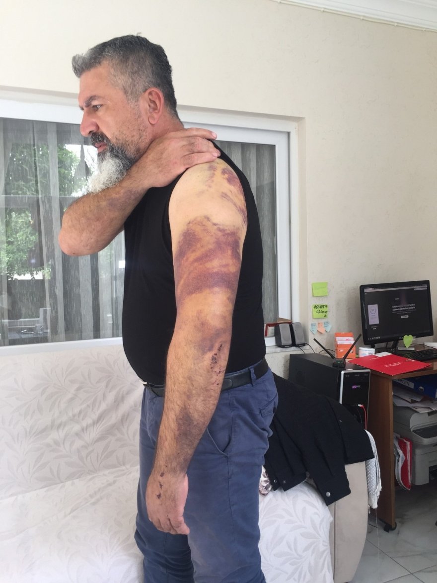 Esrarengiz kazanın ardından öldüresiye dövüldü