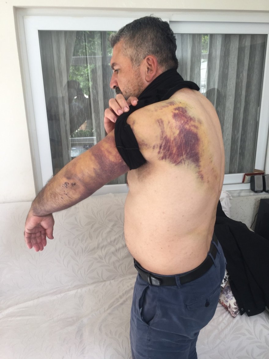 Esrarengiz kazanın ardından öldüresiye dövüldü