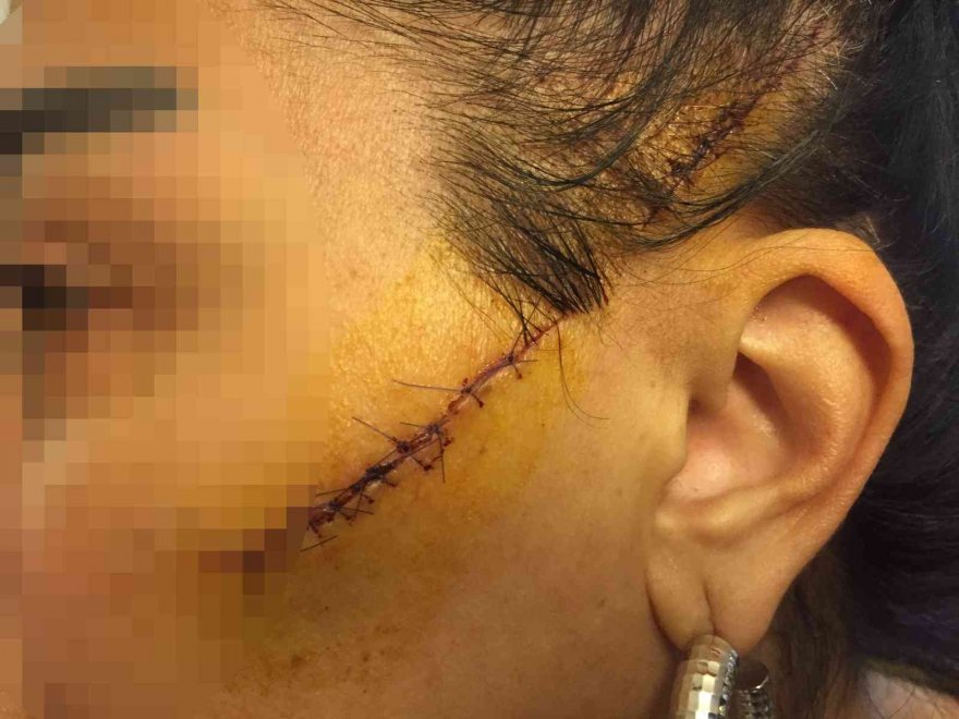 Adana'da saplantılı aşık dehşeti: Darp etti, kurşun sıktı...