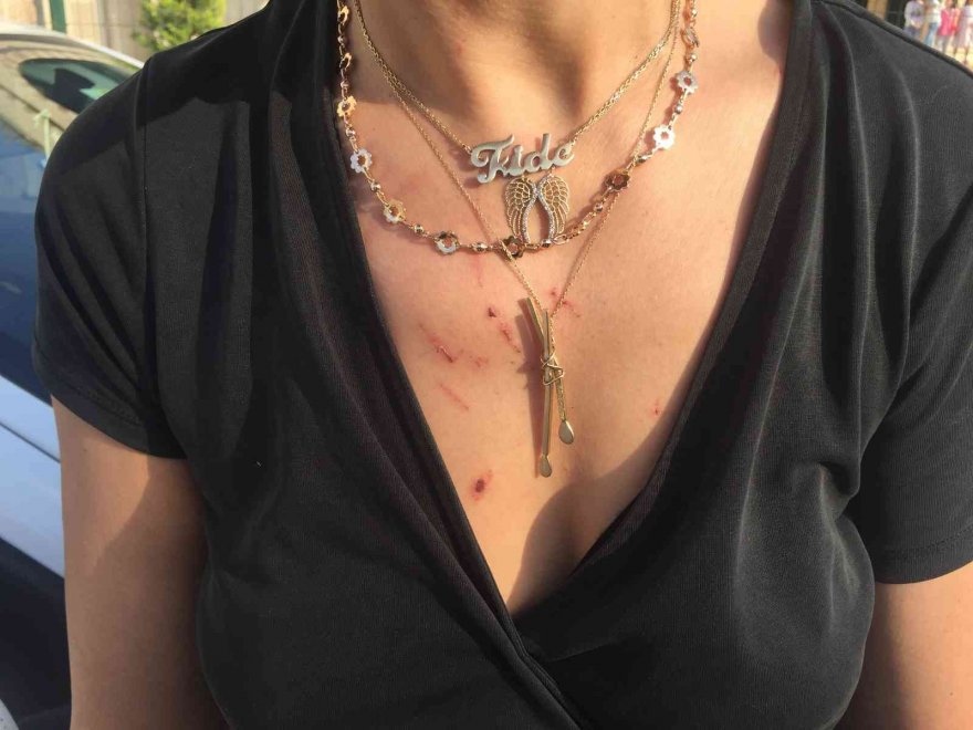 Evde, asansörde tacize uğradı, işkence gördü: Ben öldükten sonra hakkımı savunmayın