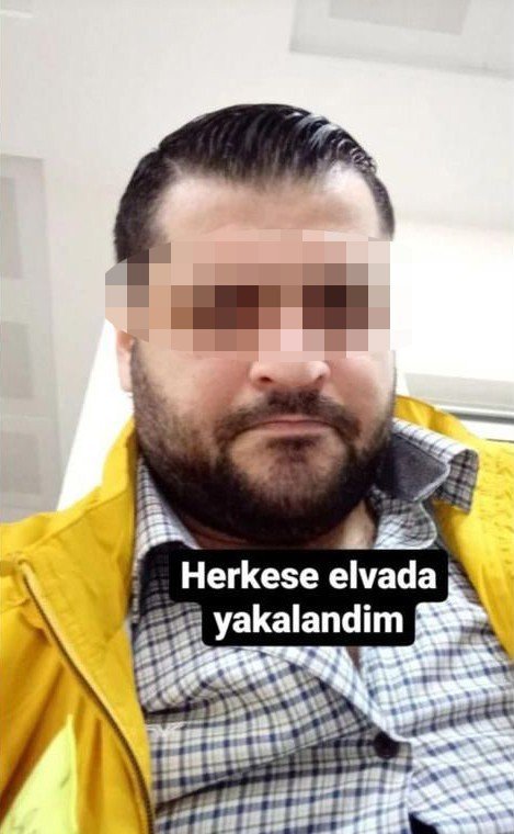 Eski sevgilisinin yüzünü usturayla kesen aşığa ‘indirimsiz’ 6 yıl ceza