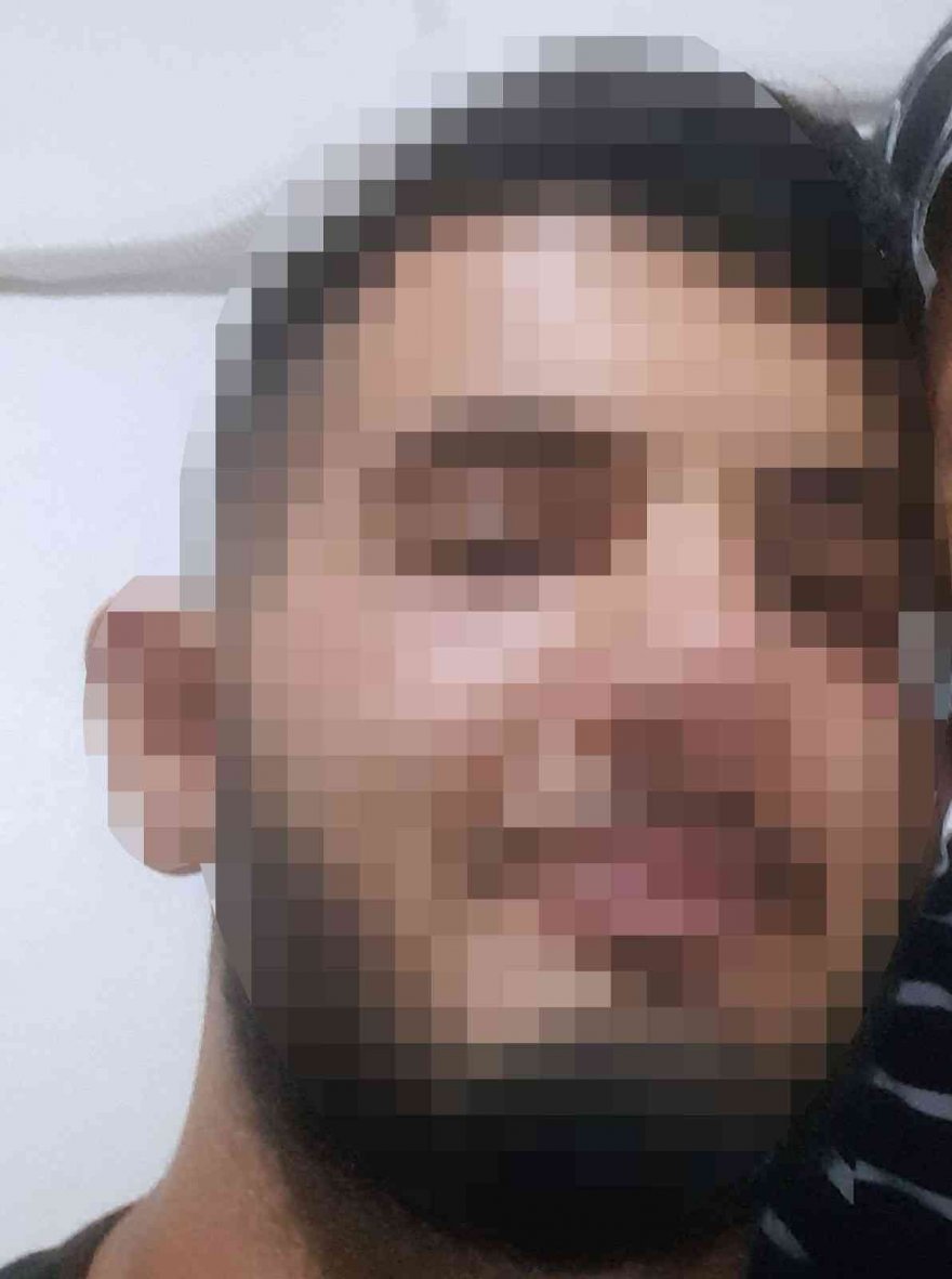 Üvey annesine kezzap döken genç tutuklandı