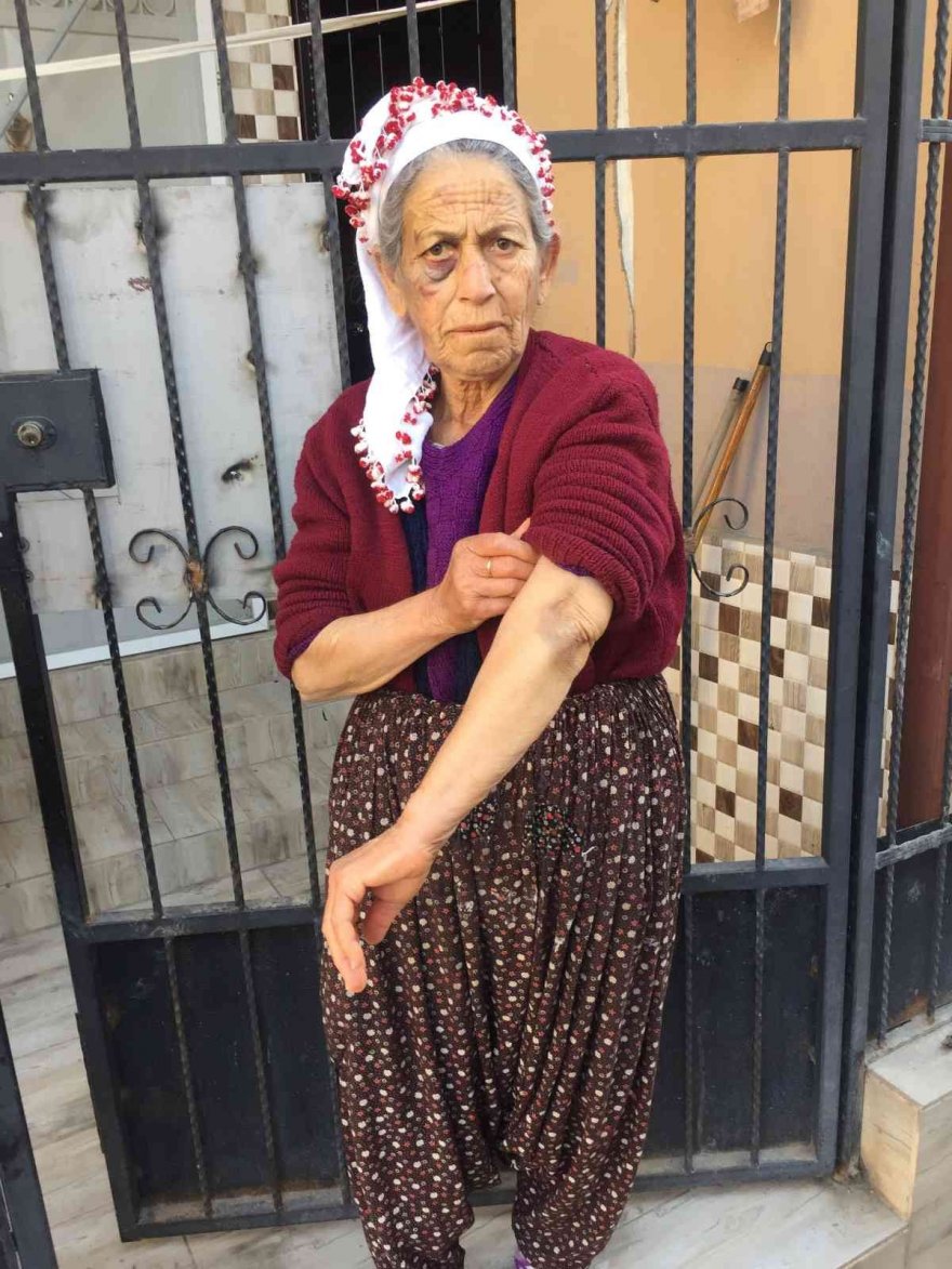 Kanser hastası yaşlı kadını dakikalarca dövüp gasp etti