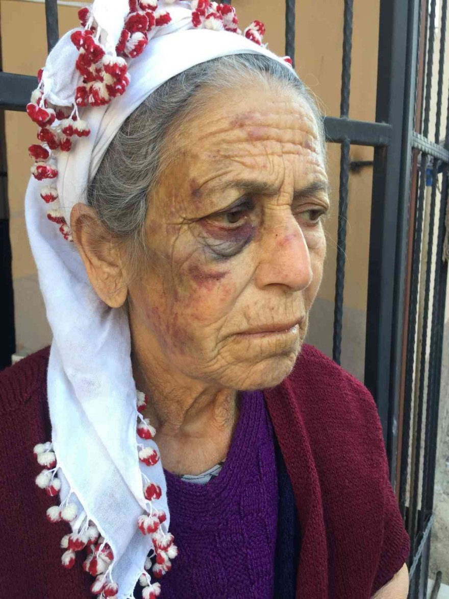 Kanser hastası yaşlı kadını dakikalarca dövüp gasp etti
