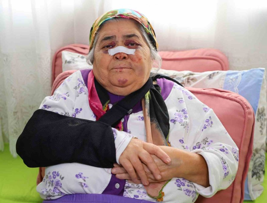 Otomobilin çarptığı yaşlı kadın: "Gözümün içine bakıp kaçtı"