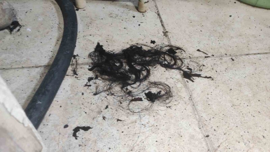 Boşandığı eşi tarafından yakılan kadın 36 günlük yaşam savaşını kaybetti