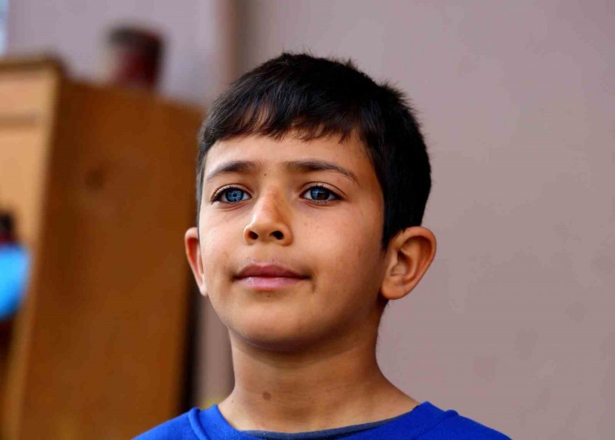 Hayata çift renk bakıyor, görenler hayrete düşüyor