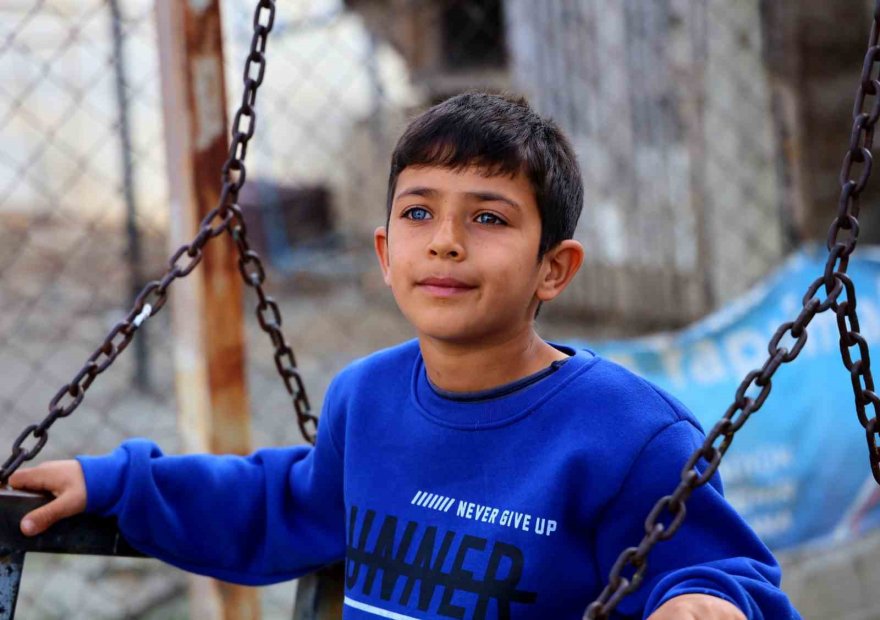 Hayata çift renk bakıyor, görenler hayrete düşüyor