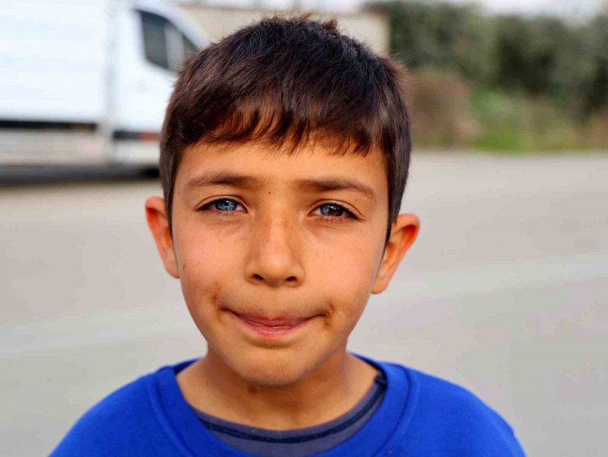 Hayata çift renk bakıyor, görenler hayrete düşüyor