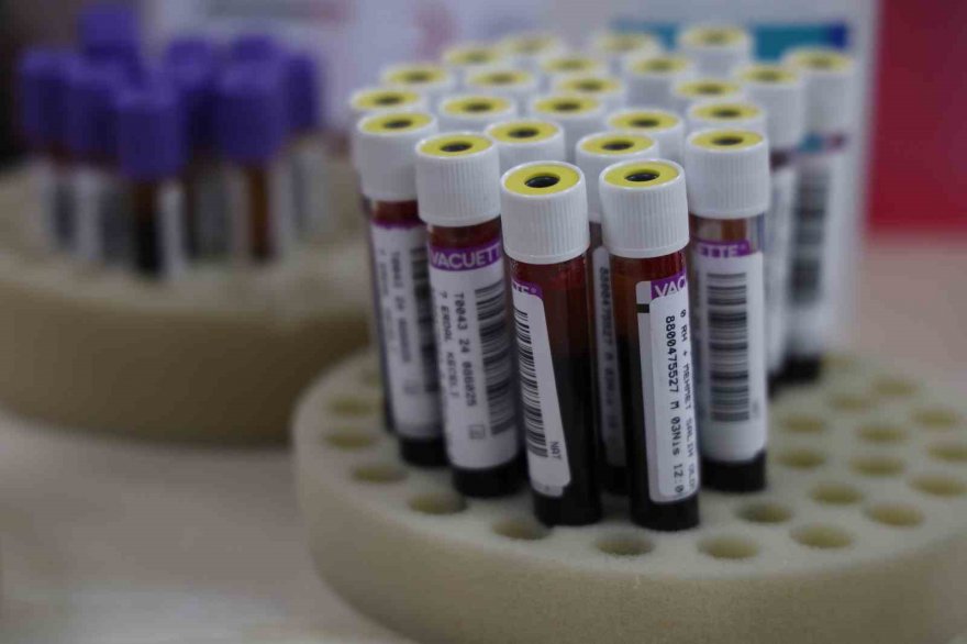 Kızılay’dan azalan kan stokları için çağrı