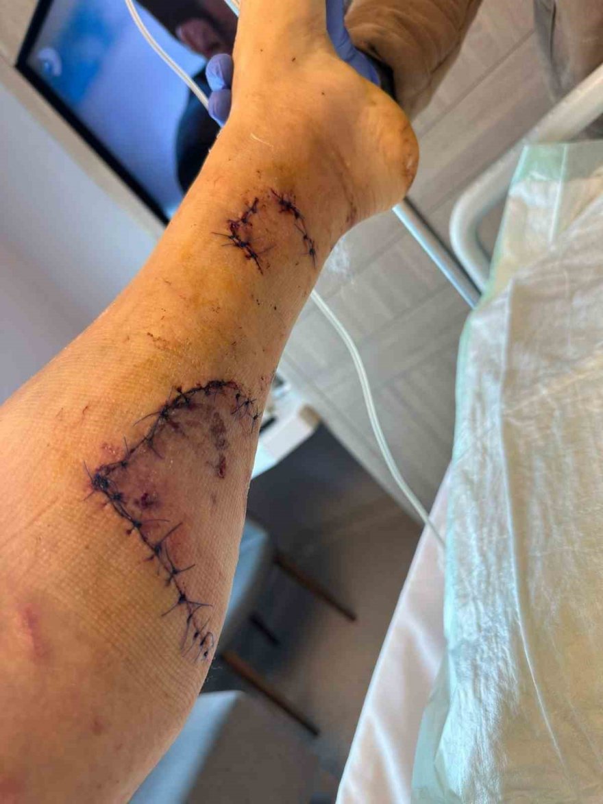 Çin Aslanı evdeki diğer köpekten sahibini kıskanarak bacağını parçaladı