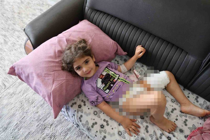 Köpeğin ısırdığı kız çocuğu: 