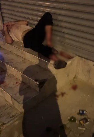 Adana’da evden kaçan pitbull dehşeti kamerada: Sahibini ve 2 kişiyi yaraladı