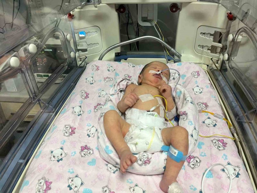 Annesi kazada ölüp sezaryenle dünyaya gelen bebek hayata tutundu