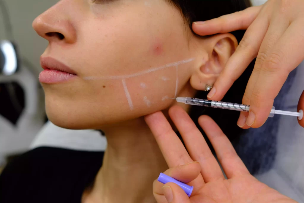 masseter-botoksu-2-1024x683.webp